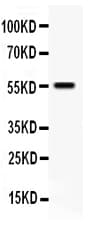 Polyclonal Rabbit anti-Human TFPI / LACI Antibody (aa261-280, IHC, WB)