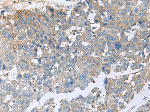 CEMIP / KIAA1199 Antibody