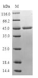 Mouse MB / Myoglobin Protein (Recombinant 10His, N-terminus + Myc, C-terminus)