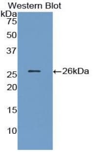 ANGPT1 / Angiopoietin-1 Antibody (aa21-228, APC)