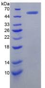 Human MYC / c-Myc Protein (Recombinant His-GST, N-terminus)