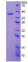KRT18 / CK18 / Cytokeratin 18 Protein (Recombinant His-T7)