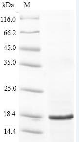 Anaplasma phagocytophilum rplV Protein (Recombinant 10His, N-terminus + Myc, C-terminus)