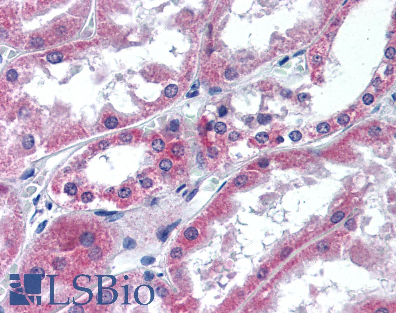 IHC-plus™ Polyclonal Rabbit anti-Human APG12 / ATG12 Antibody (Internal, IHC, WB)
