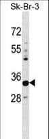 PHYHD1 Antibody (aa232-260)