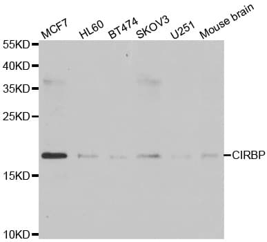 Polyclonal Rabbit anti-Human CIRP / CIRBP Antibody (IHC, IF, WB)