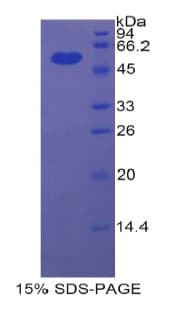 Rat ENPP1 Protein (Recombinant His-GST)