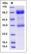 Rat IL2RG / CD132 Protein (Recombinant Human IgG Fc, C-terminus)