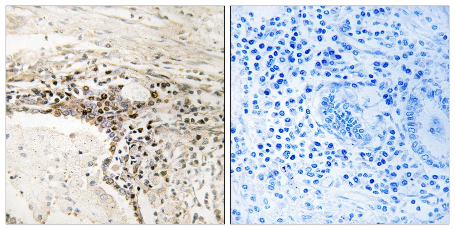 Polyclonal Rabbit anti-Human SSH3 Antibody (IHC, WB)