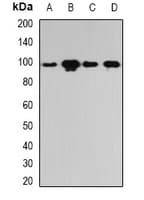 Polyclonal Rabbit anti-Human PYGL Antibody (IHC, IF, WB)