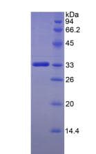Human FKBP10 / FKBP65 Protein (Recombinant His)
