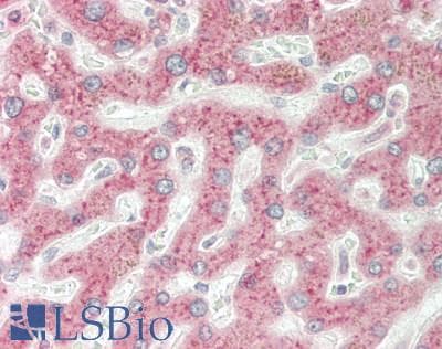 IHC-plus™ Polyclonal Rabbit anti-Human GSTP1 / GST Pi Antibody (N-Terminus, IHC, WB)