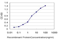 Monoclonal Mouse anti-Human CRYBB1 Antibody (clone 2B2, WB)