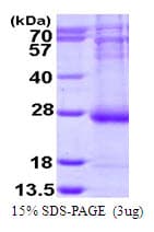 Human ARL14 Protein (Recombinant His)