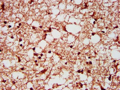 SF3B1 Antibody