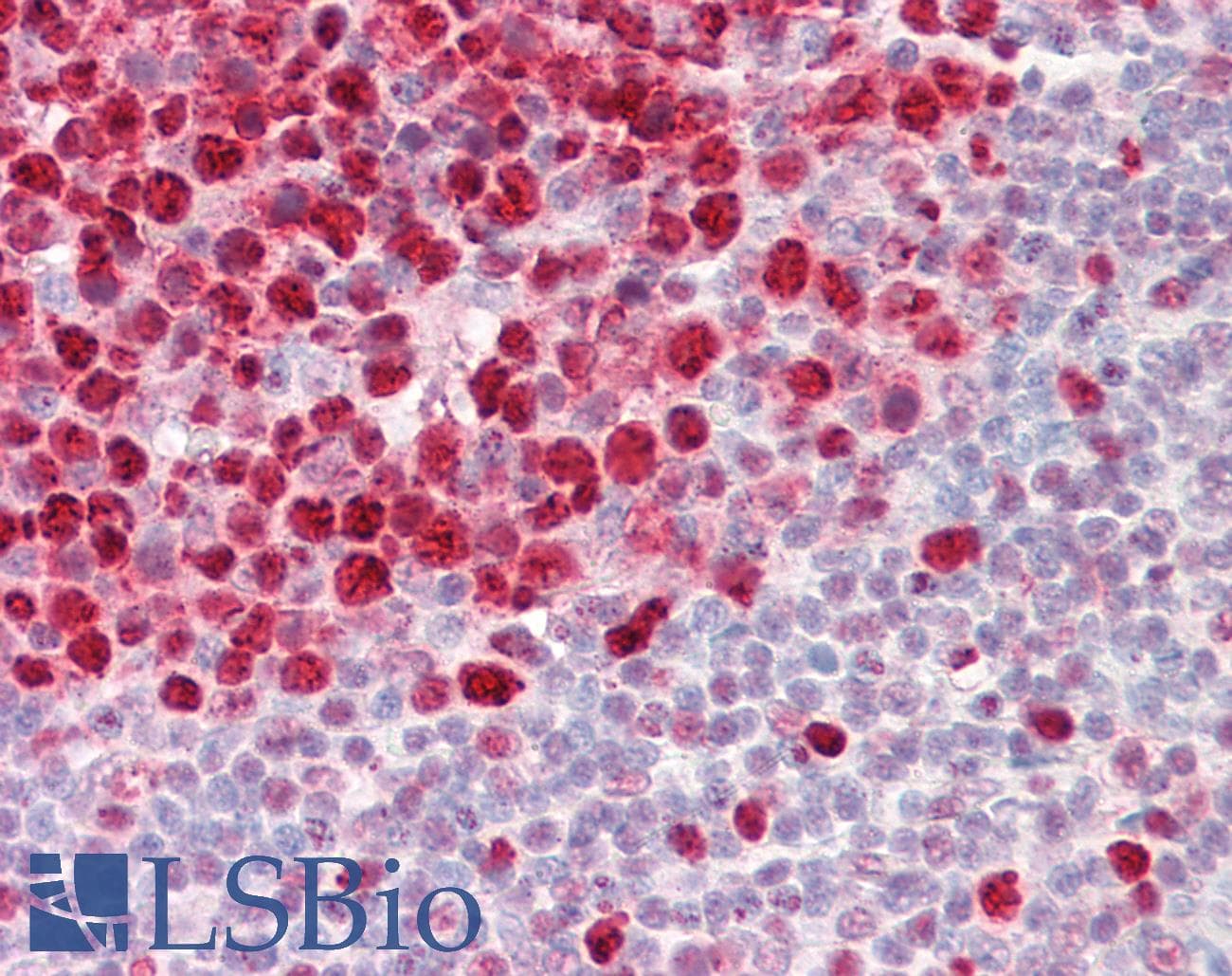 PathPlus™ Monoclonal Mouse anti-Human PCNA Antibody (clone PC10 (a.k.a. 3F81), IHC, WB)