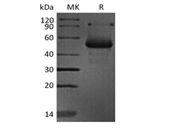 Human CD40L Protein (Recombinant Mouse IgG1 Fc, N-terminus)