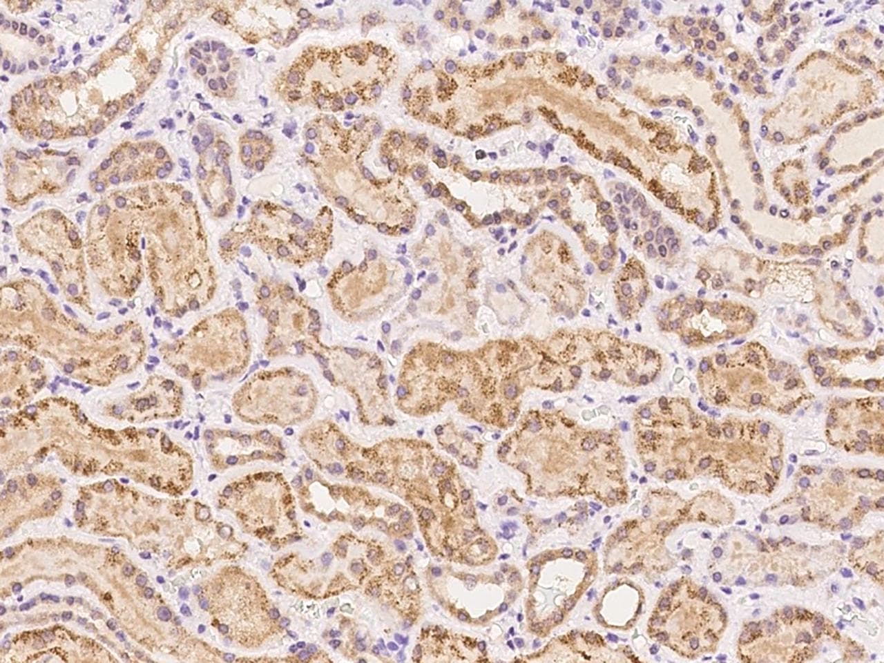FABP12 Antibody