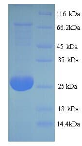 Bovine Adiponectin Protein (Recombinant 6His, N-terminus)