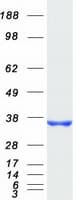 Human CYB5R3 / B5R Protein (Recombinant Myc-DDK (Flag))