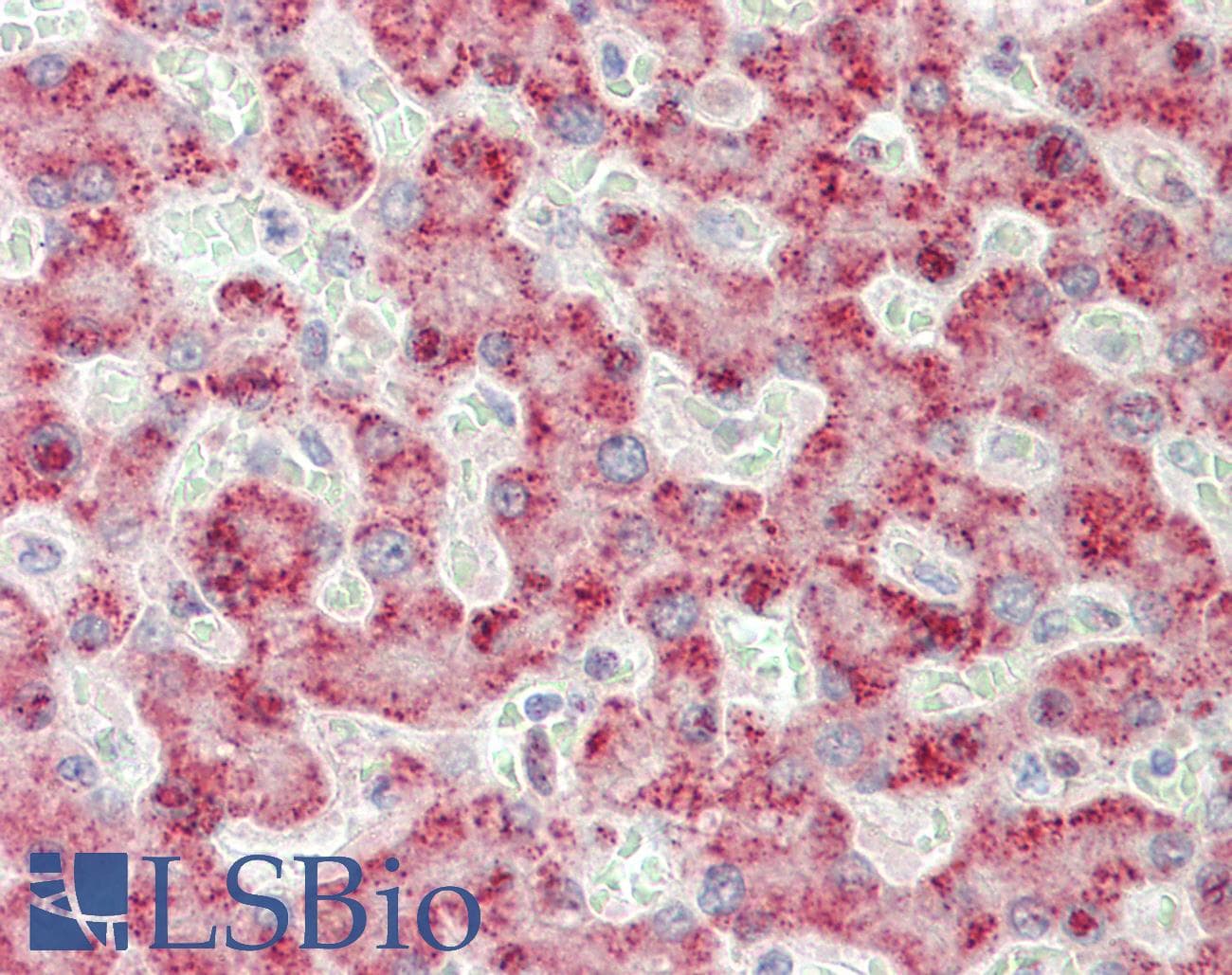 IHC-plus™ ACOX1 / ACOX Antibody