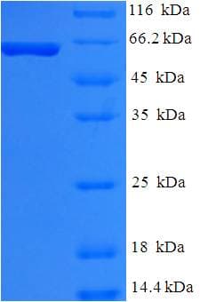 Human PMEL / SILV / gp100 Protein (Recombinant 6His-SUMO, N-terminus)
