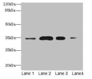 M-PST / STM Antibody