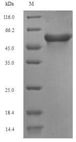 Rat Acetyl-CoA Carboxylase / ACC Protein (Recombinant 6His, N-terminus)