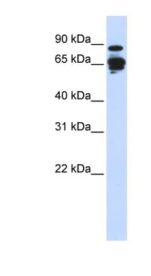 AMPH / Amphiphysin Antibody (N-Terminus)