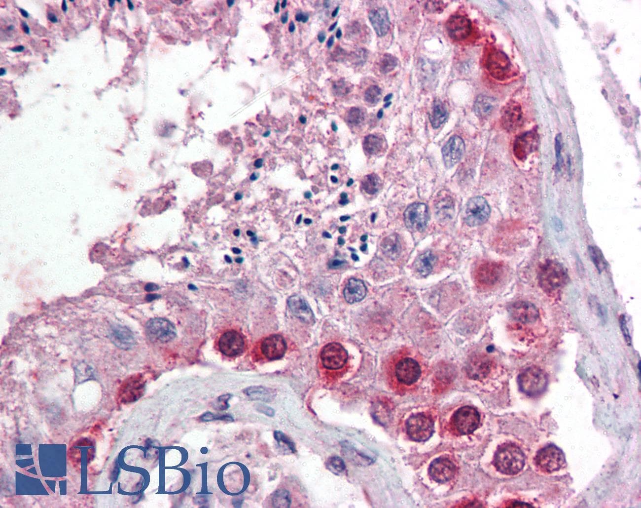 IHC-plus™ Cullin 4A / CUL4A Antibody (aa1-25)