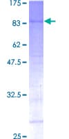 Human MEN1 / Menin Protein (Recombinant GST)
