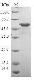 Human YWHAQ / 14-3-3 Theta Protein (Recombinant GST, N-terminus)