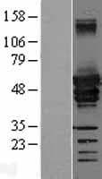 DES / Desmin Protein (Over-Expression Lysate Myc-DDK (Flag))