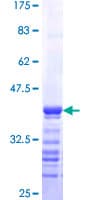 Human RTKN / Rhotekin Protein (Recombinant GST, N-terminus)