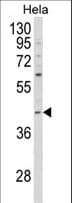Polyclonal Rabbit anti-Human NCK1 / NCK Antibody (aa3-29, WB)