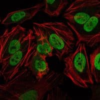 PRKDC / DNA-PKcs Antibody (clone 3H6)