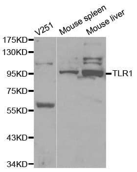 Polyclonal Rabbit anti-Human TLR1 Antibody (IHC, IF, WB)