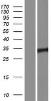 POU1F1 / PIT1 Protein (Over-Expression Lysate Myc-DDK (Flag))