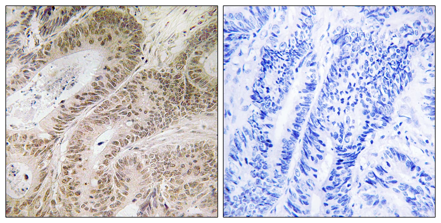 RDM1 Antibody (aa118-167)