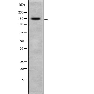 MED23 / SUR2 Antibody