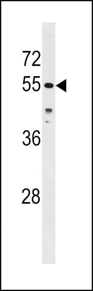 CHEK1 / CHK1 Antibody (aa274-302)