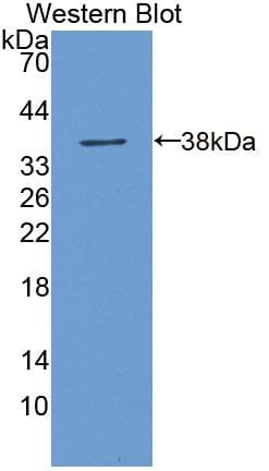 ALDH3A1 Antibody (aa1-311)