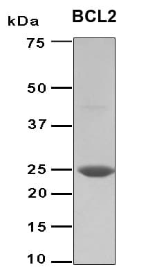 Human BCL2 / Bcl-2 Protein (Recombinant 6His, N-terminus)