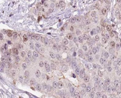 CGB / hCG Beta Antibody (aa122-148)