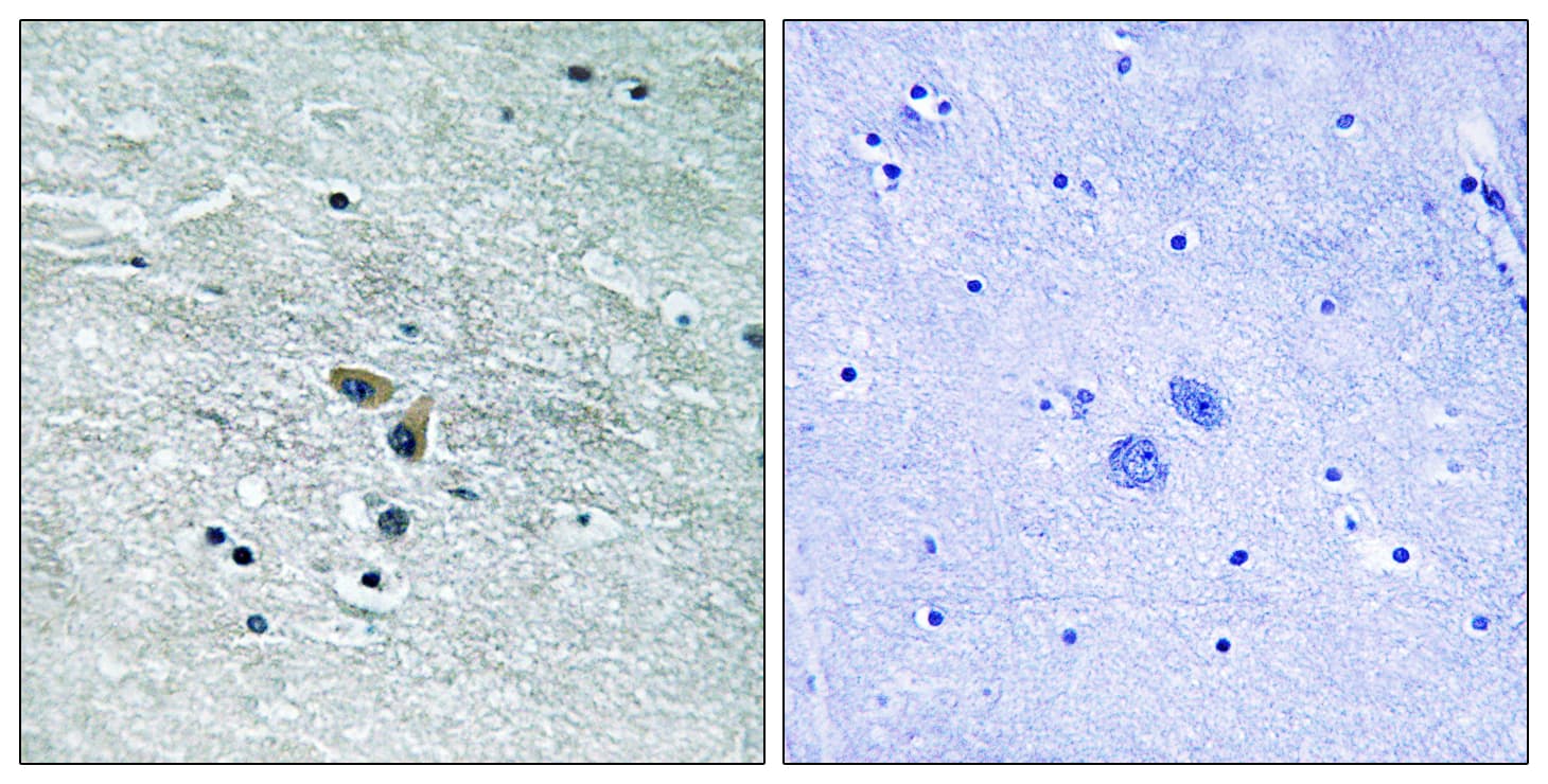 MAP3K8 / TPL2 Antibody (aa366-415)