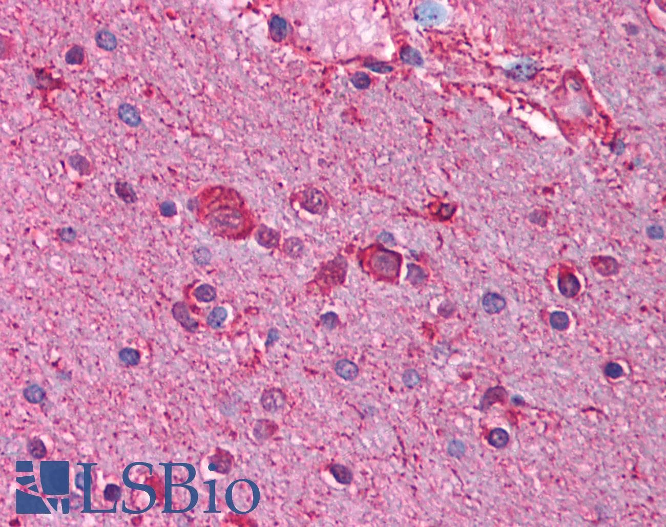 CHRNB3 Antibody (aa176-225)
