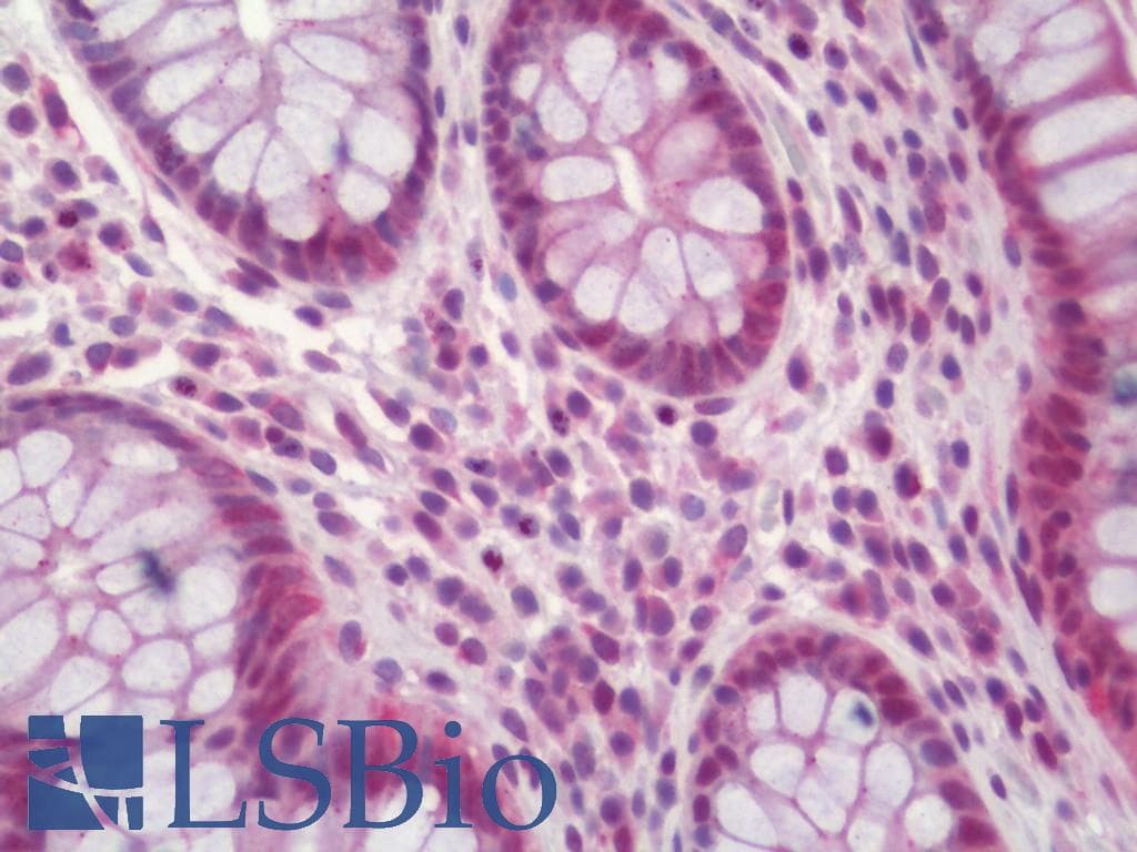 IHC-plus™ CKLF Antibody (aa161-210)
