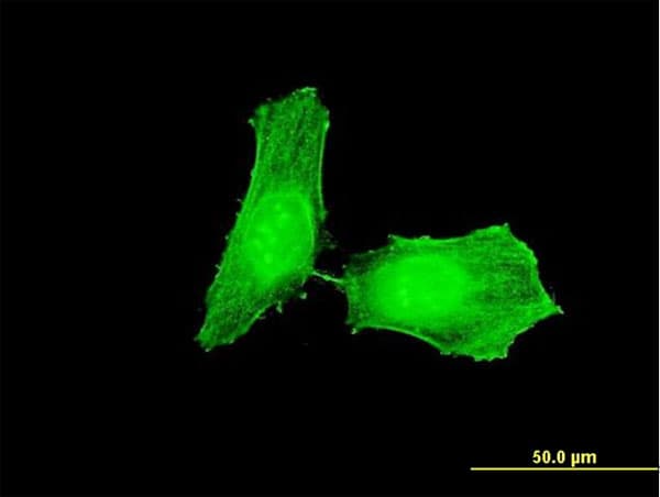 CHEK1 / CHK1 Antibody (clone 2G3)
