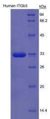 Human ITGB3 / Integrin Beta 3 / CD61 Protein (Recombinant His, N-Terminal)