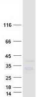 Human SRSF12 Protein (Recombinant Myc-DDK (Flag))
